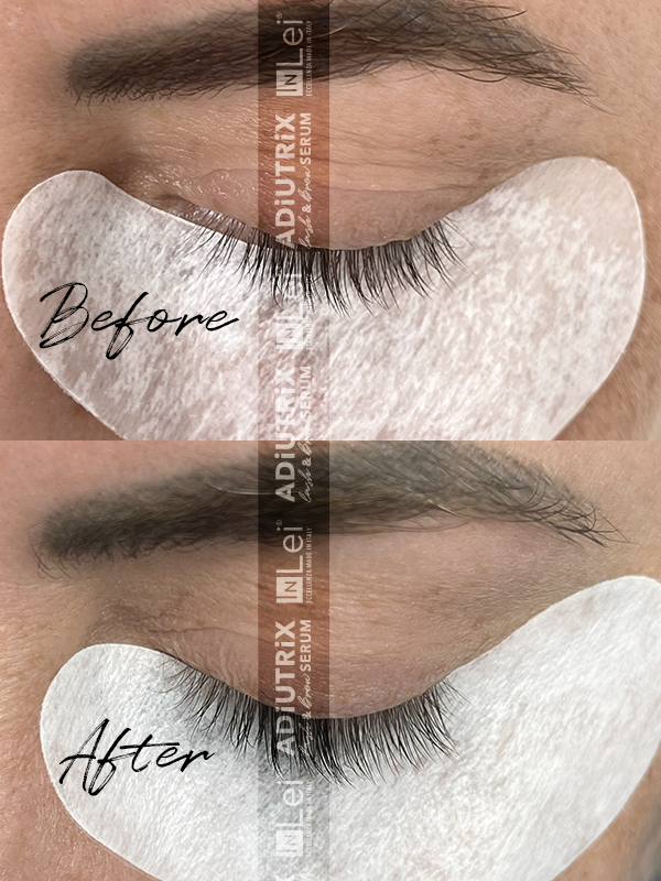 InLei Adiutrix Serum