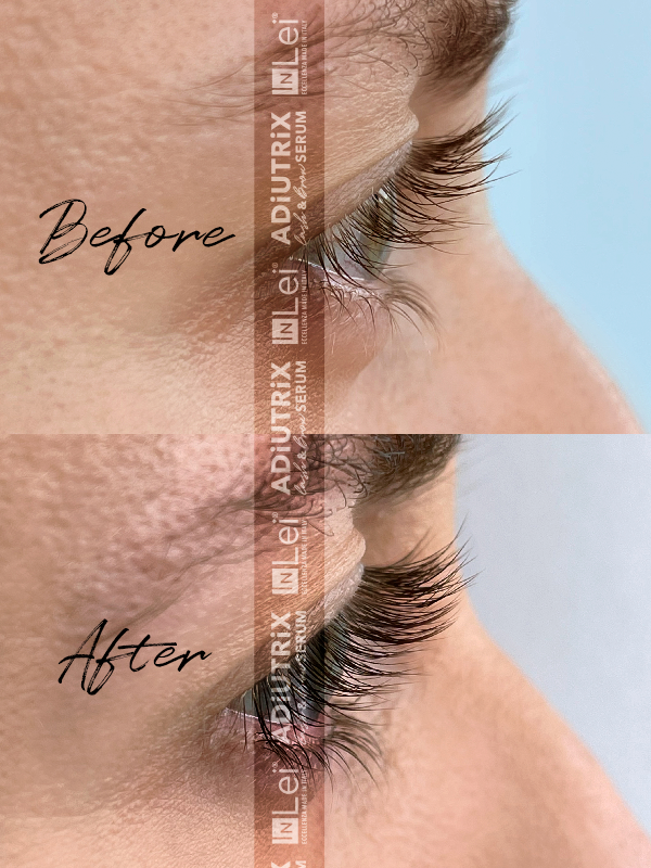 InLei Adiutrix Serum